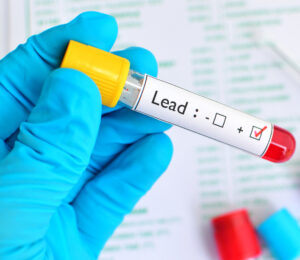 Lead Poisoning Test